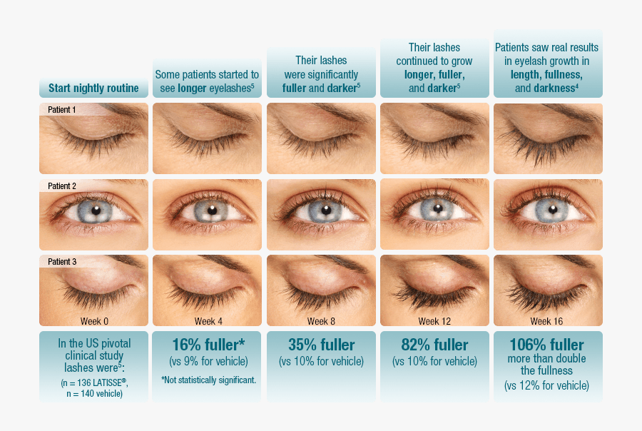 Lash Fullness Chart Double Eyelashes Vs Normal , Free Transparent