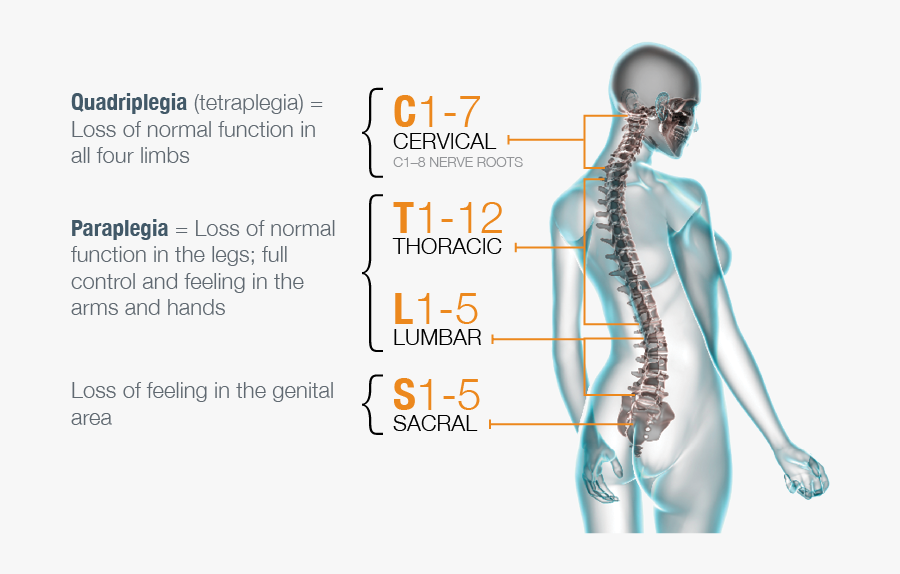 A Damaged Spinal Cord Not Only Means Losing Control - Paraplegia Tetraplegia Quadriplegia, Transparent Clipart