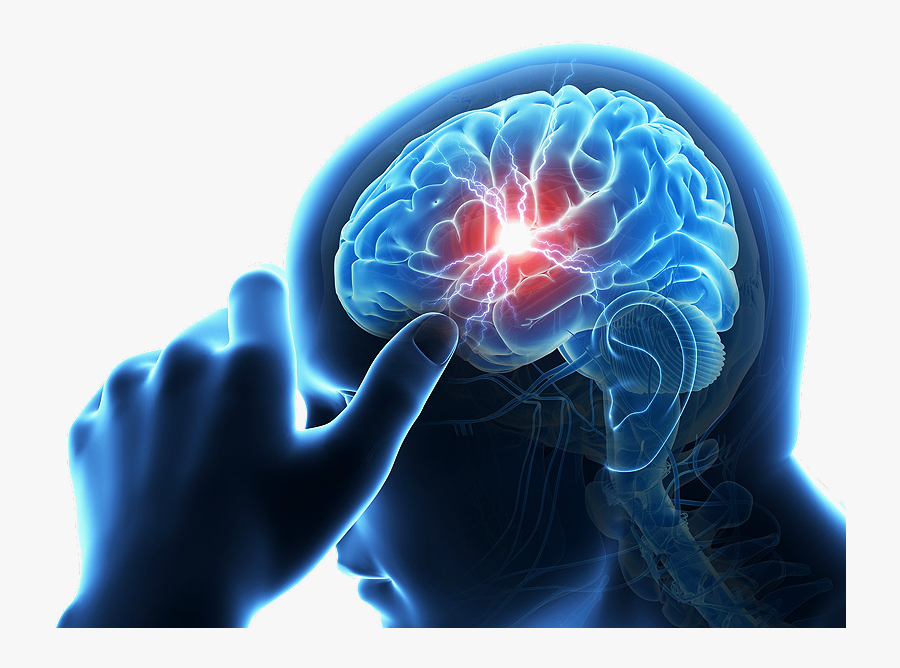 Risk Carotid Stroke Chiropractic Care - Brain Stroke Transparent, Transparent Clipart