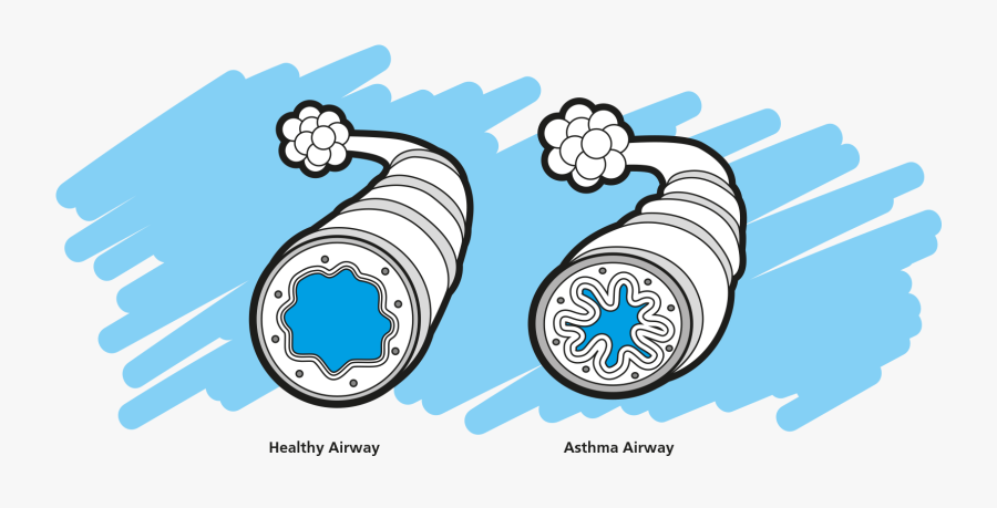 Clip Art Asthma Pictures - Asthma Relievers And Preventers, Transparent Clipart