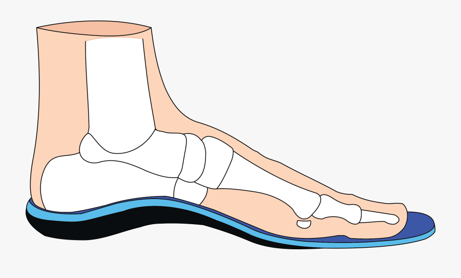 Yes Orthosis Bones Resonance - Ankle Clipart Transparent, Transparent Clipart