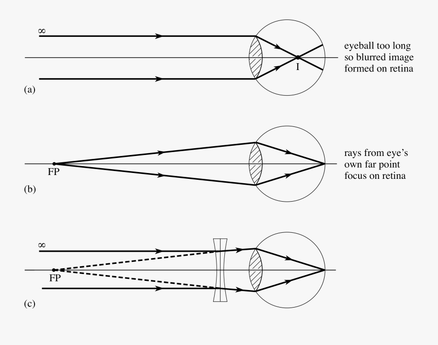 Sighting Drawing Straight Line - Short Sighted Ray Diagram, Transparent Clipart