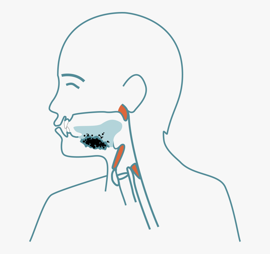 What Is Dysphagia Symptoms - Afl Football Field Template, Transparent Clipart