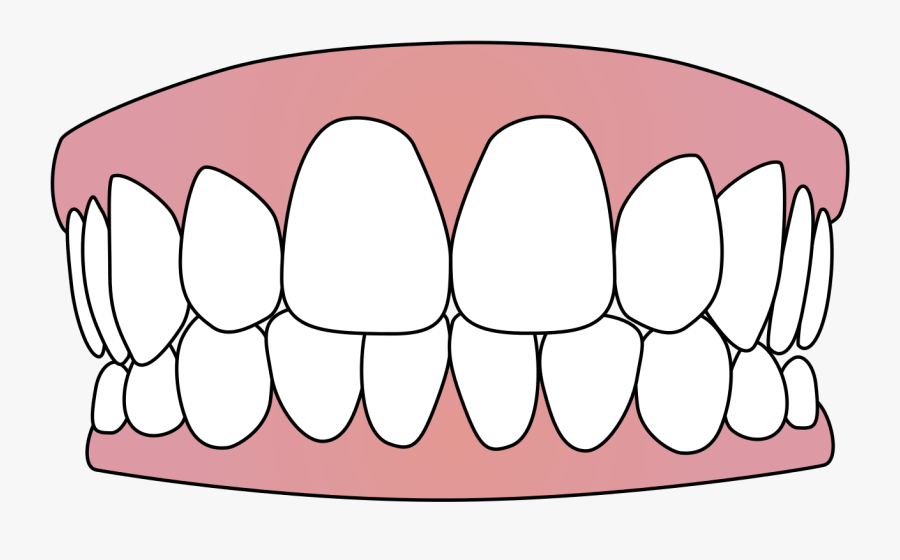 Jaw,tooth,mouth,clip - Funny False Teeth Cartoon, Transparent Clipart