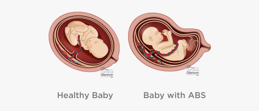 Children’s Healthcare Of Atlanta, Transparent Clipart