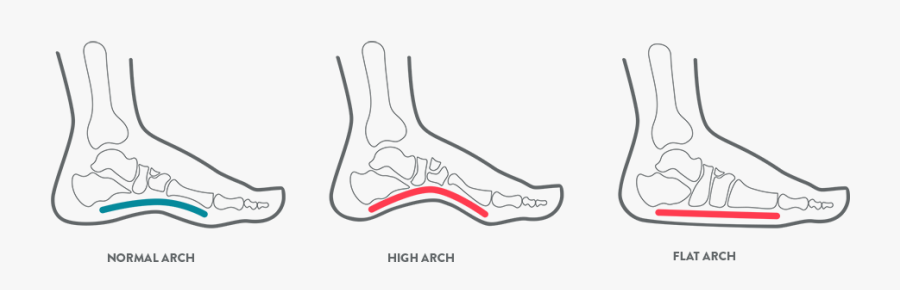 A Kids Foot Health Diagram Illustrating Arch Position - Kids Foot Bone, Transparent Clipart