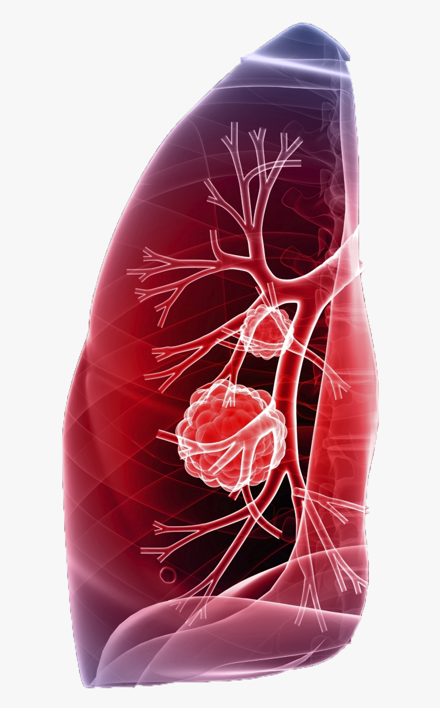 Treatment Nsclc Guidelines 2019, Transparent Clipart