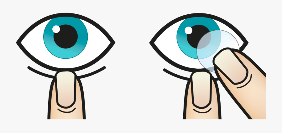 Looking Up, Place The Lens Gently On The Lower White - Retrait Lentilles Cornéennes, Transparent Clipart