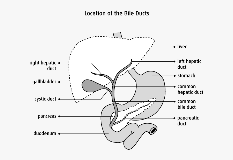 Wk 4 Biliary Tree Pathology Diagram Of Location Of - Pancreatic Cancer Palliative Surgery, Transparent Clipart