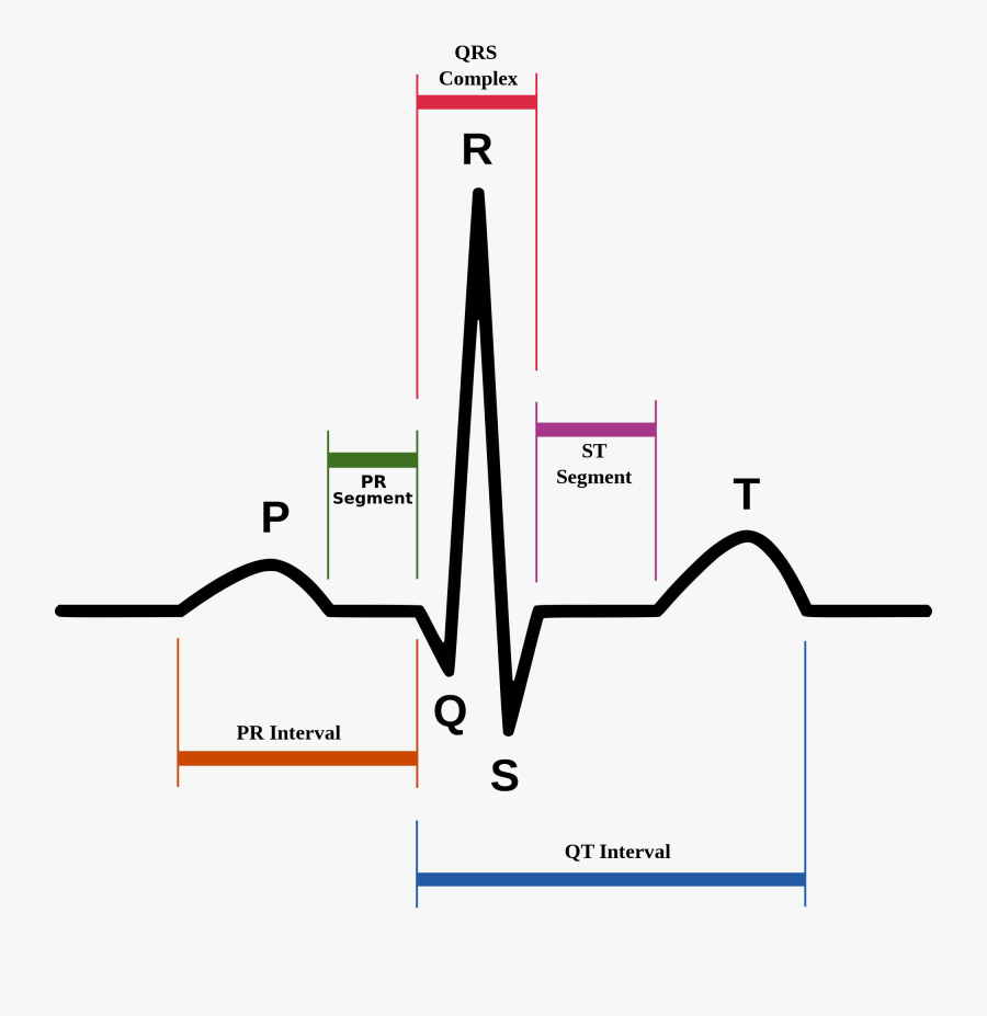 Clip Art Cme Ecg Interpretation Charlie - Normal Sinus Rhythm, Transparent Clipart