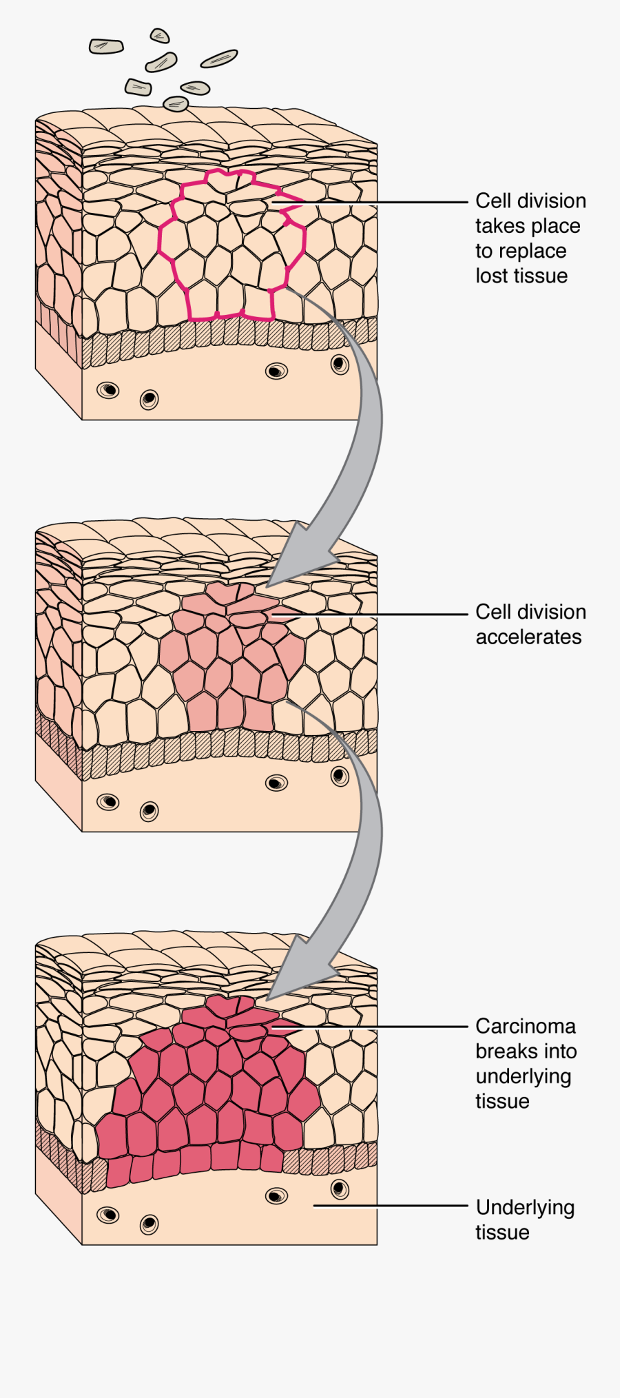 Cell Clipart Malignant - Tissue Repair Diagram , Free Transparent ...