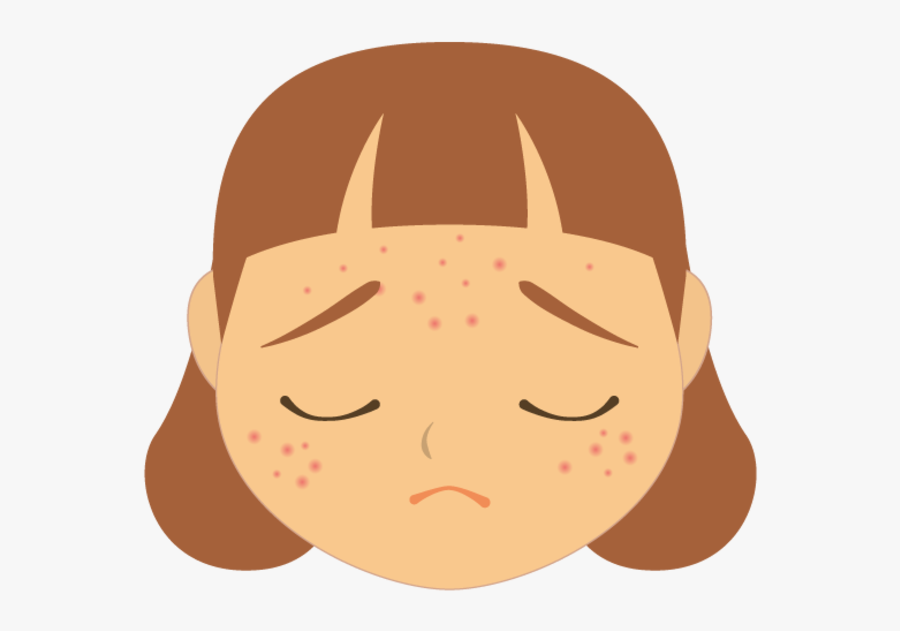 Face With Acne Cartoon , Free Transparent Clipart - ClipartKey