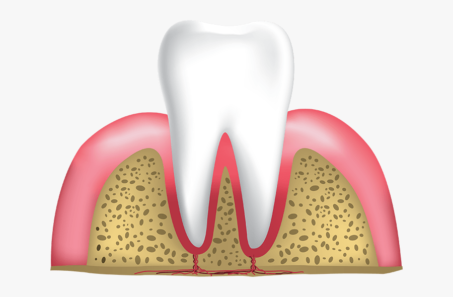 Healthy Gums And Tooth Lafayette In - Dental Implant Fibers, Transparent Clipart