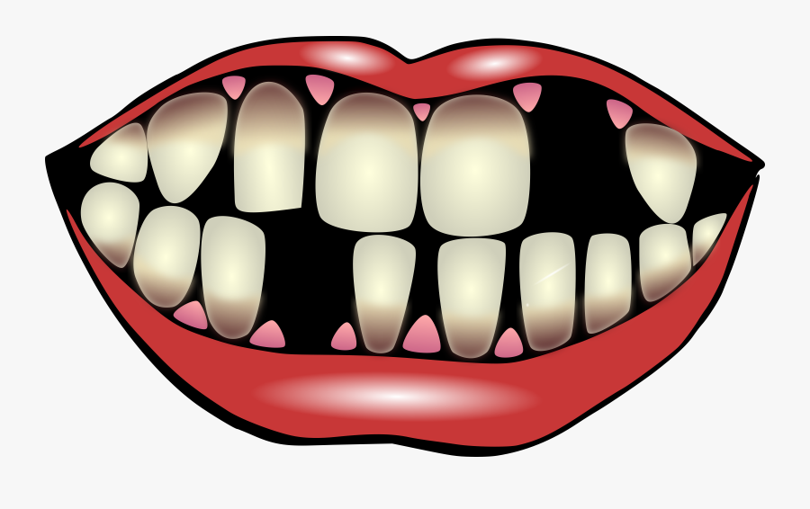 Clipart Of Teeth, Affects And Pediatric Clipart Of, Transparent Clipart