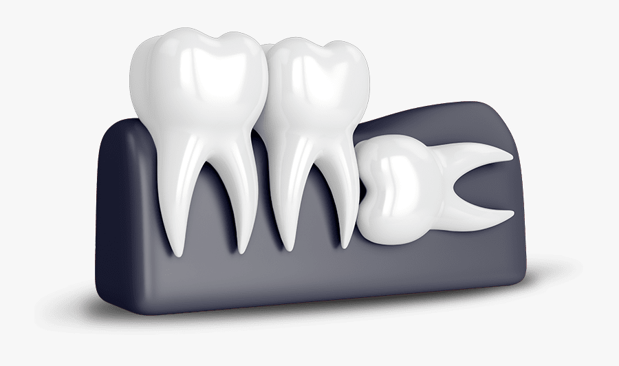 Wisdom Tooth Extraction - Tooth Wisdom, Transparent Clipart