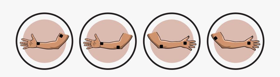Ulnar Nerve Lesion Electrode Pad Placement Clipart - Mole, Transparent Clipart