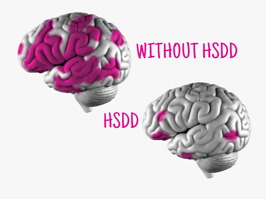 Hsdd Brain, Transparent Clipart