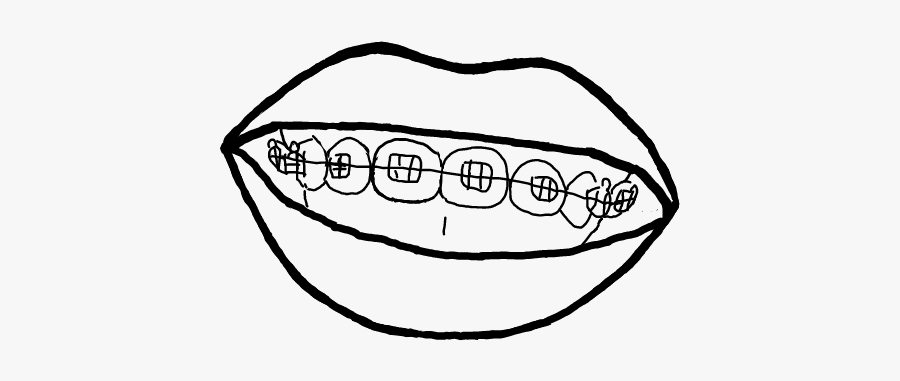 #brackets #sonrisa #dibujo #blancoynegro - Sketch , Free Transparent 