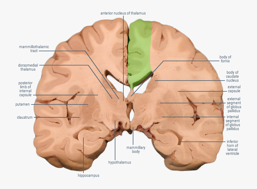 Anterior Cerebral Artery Segments Motor Cortex, Transparent Clipart