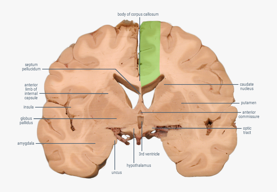 Coronal View Of Amygdala, Transparent Clipart