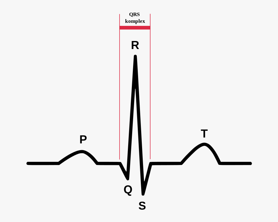 Qrs на экг