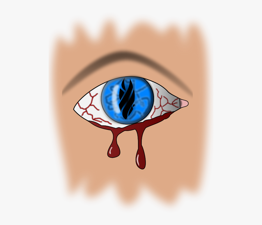 Free Bleeding Eye - Retinal Hemorrhage, Transparent Clipart