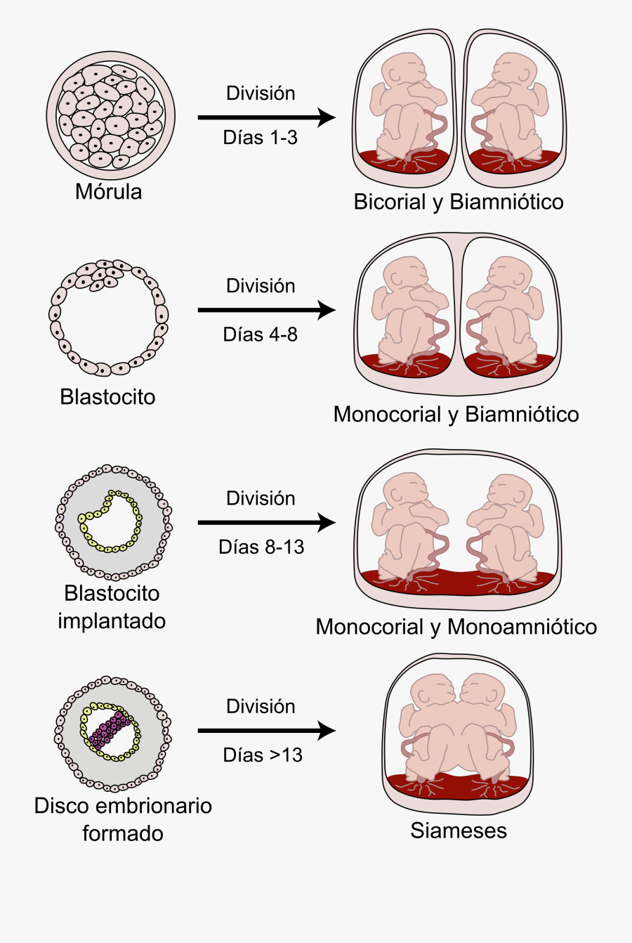 Monochorionic Diamniotic Twins, Transparent Clipart