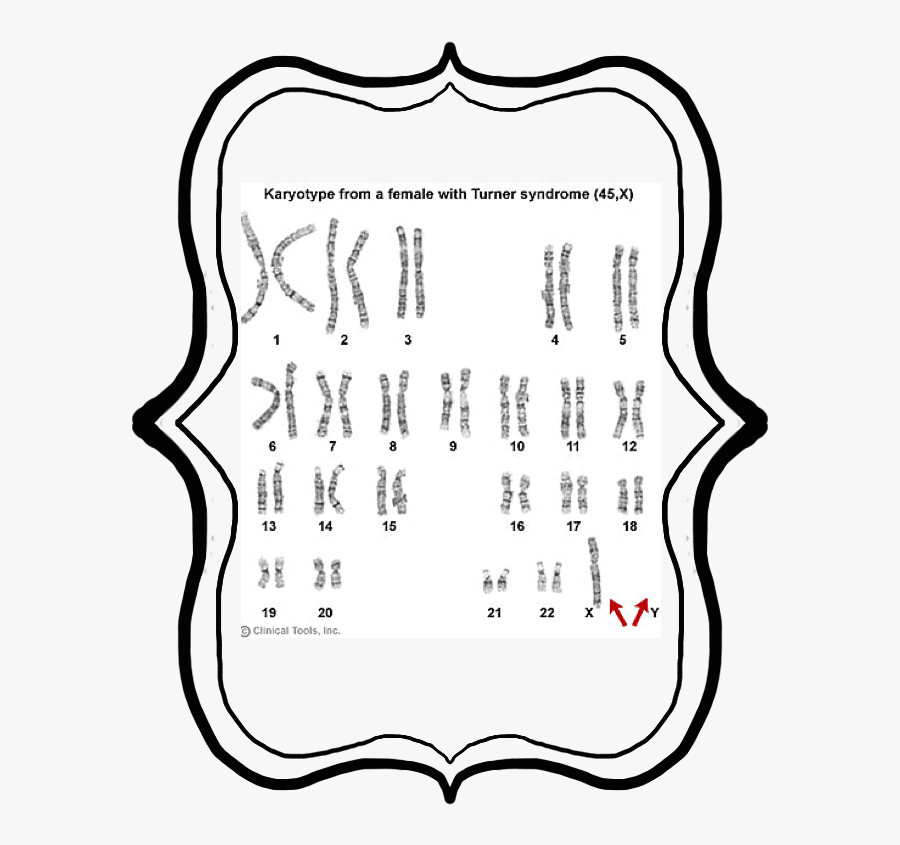 Haploid Vs Diploid Karyotype, Transparent Clipart