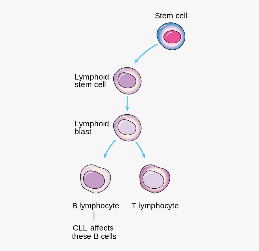 Clip Art Burr Cell - Acute Lymphoblastic Leukemia Formation, Transparent Clipart