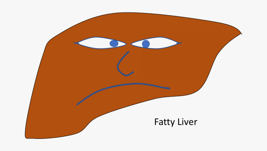 Non-alcoholic Fatty Liver Disease Clipart , Png Download, Transparent Clipart