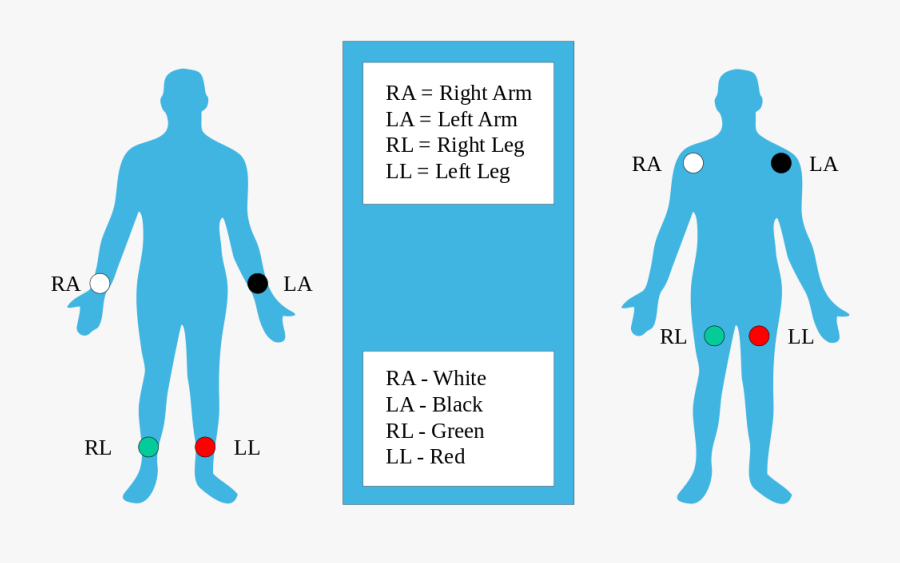 Ekg Clipart Ekg Strip - Ra La Rl Ll, Transparent Clipart