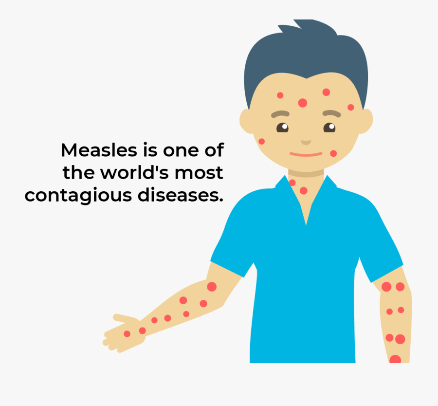 Measles Outbreak - Cartoon, Transparent Clipart