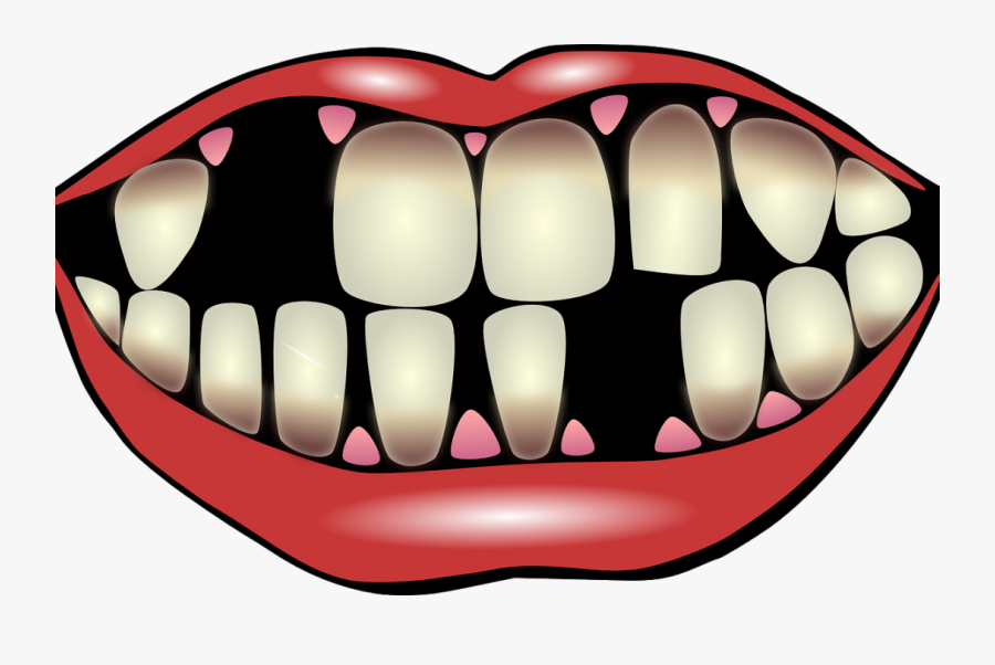 Teeth Clipart Gingivitis - Bad Teeth Png , Free Transparent Clipart