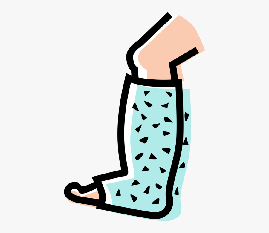 Vector Illustration Of Accident Patient With Broken - Broken Leg Png, Transparent Clipart