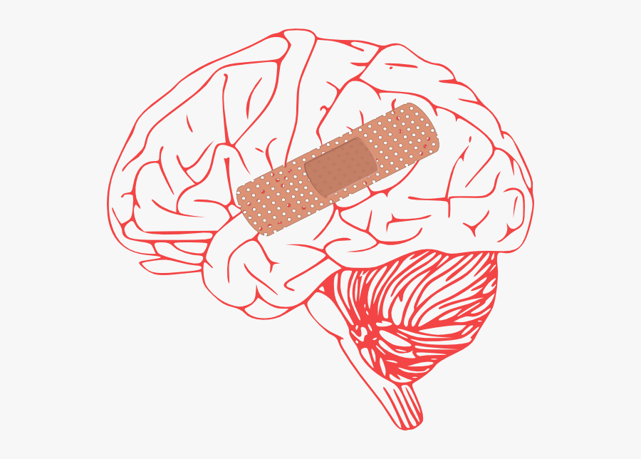 Brain Injury Clip Art At Clke - Brain Clip Art, Transparent Clipart
