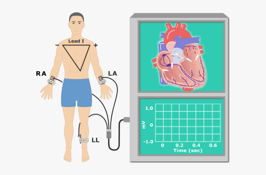 The P Wave Ekg Recording Animation Slide - Ekg Recording Clipart, Transparent Clipart