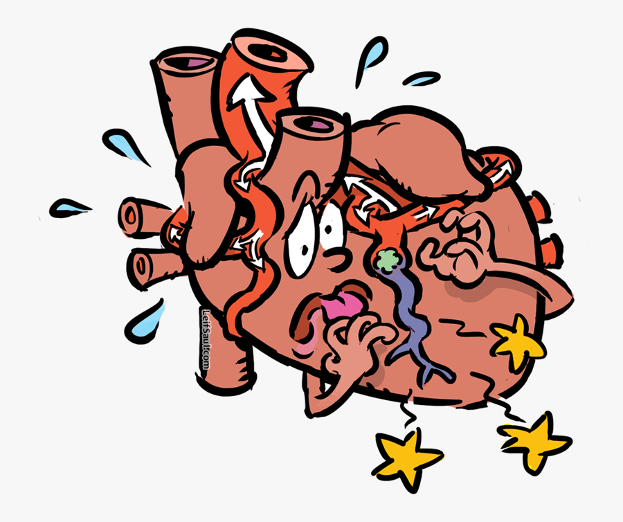 Heart With Obstructed Coronary Artery, Transparent Clipart